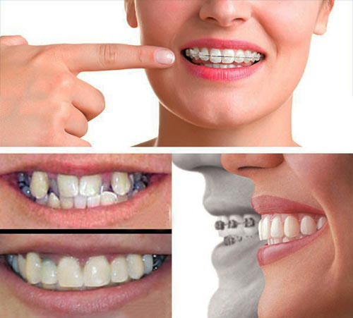 ویژگیهای خاص کلینیک دندانپزشکی دکتر هرمزی